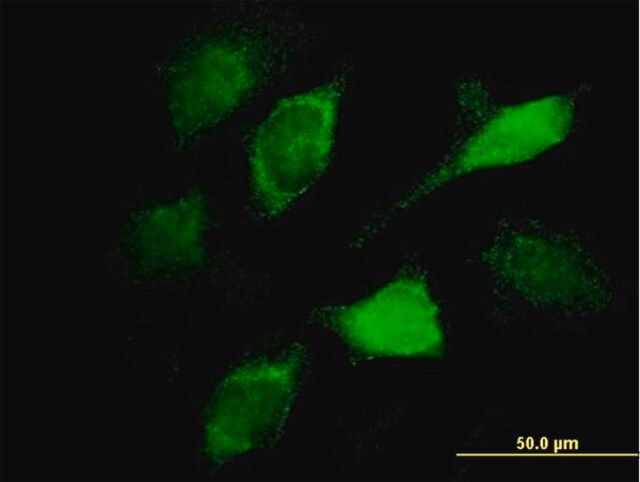 Monoclonal Anti-VAV1, (C-terminal) antibody produced in mouse