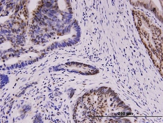 Monoclonal Anti-WT1 antibody produced in mouse