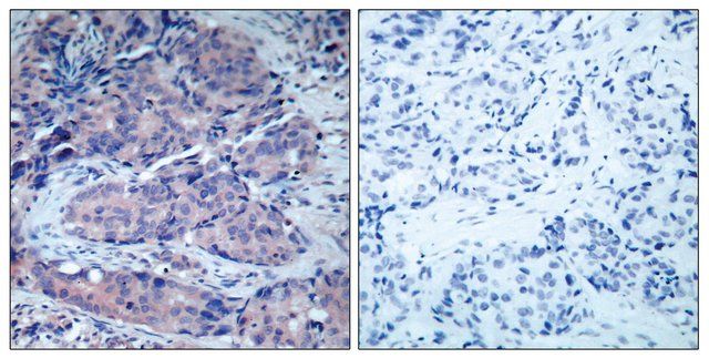 Anti-SEK1 antibody produced in rabbit