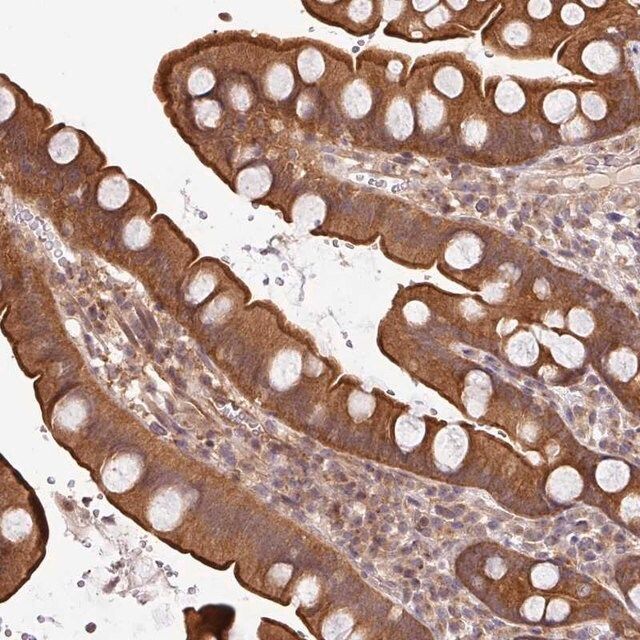 Anti-SHB antibody produced in rabbit