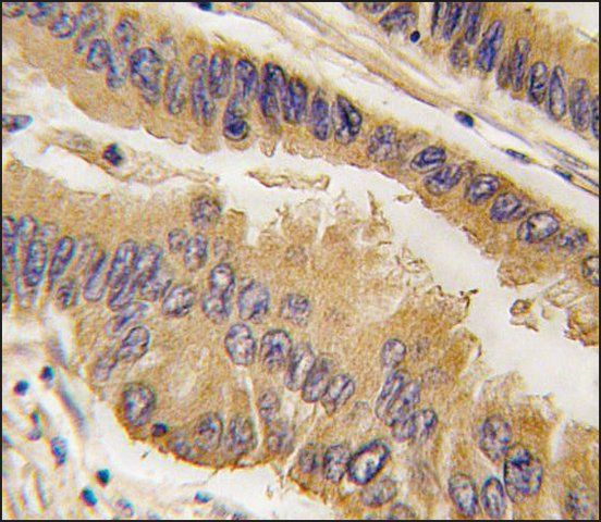 Anti-SHB (N-term) antibody produced in rabbit