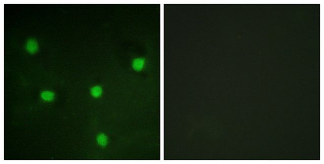 Anti-RBL1 antibody produced in rabbit