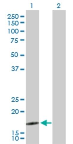 Anti-SEC61B antibody produced in rabbit