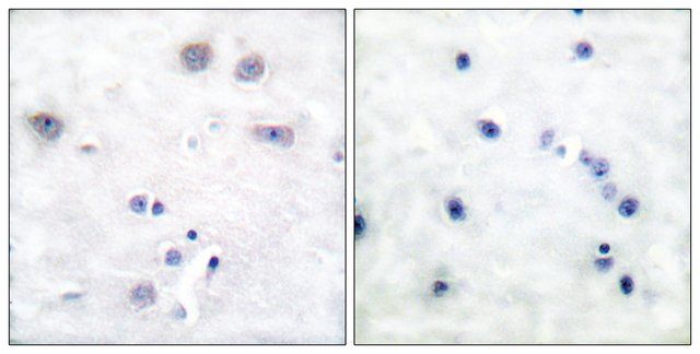 Anti-SHC antibody produced in rabbit