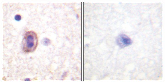 Anti-SEK1 antibody produced in rabbit