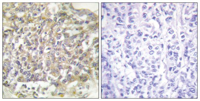 Anti-SHC antibody produced in rabbit