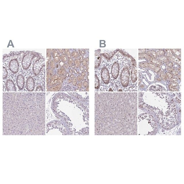 Anti-RBL1 antibody produced in rabbit