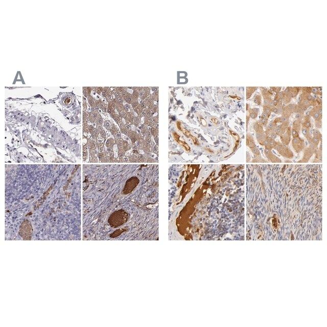 Anti-TF antibody produced in rabbit