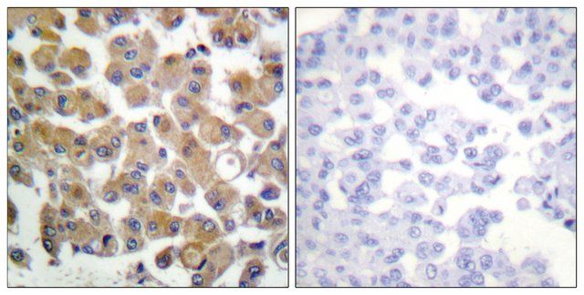 Anti-TGF 1 antibody produced in rabbit