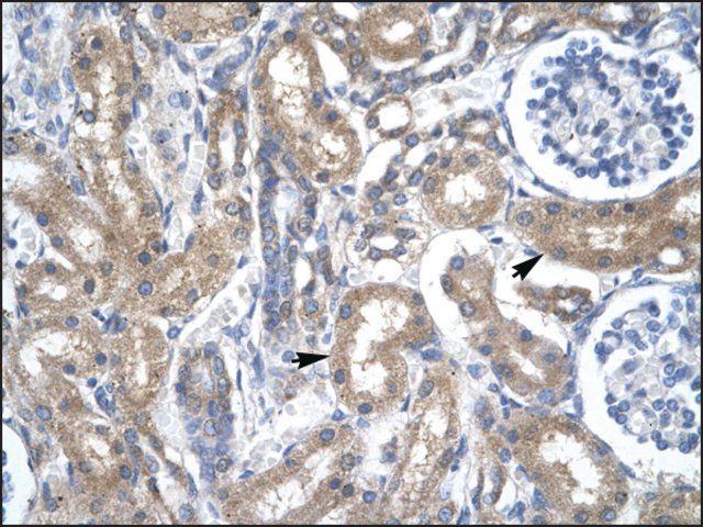 Anti-TFDP2 antibody produced in rabbit