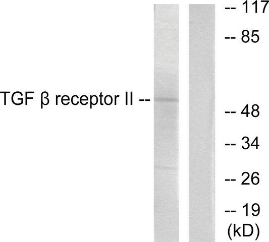 Anti-TGF  Receptor II antibody produced in rabbit