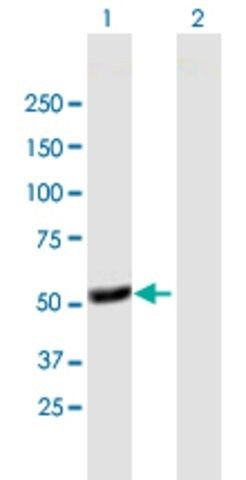 Anti-TFDP1 antibody produced in mouse