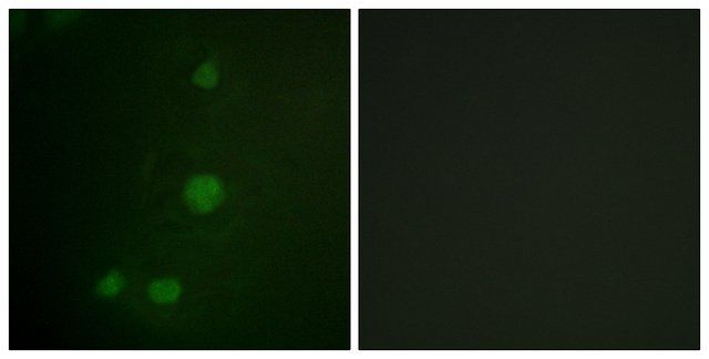 Anti-Retinoblastoma antibody produced in rabbit