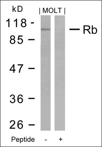 Anti-RB1 (Ab-795) antibody produced in rabbit