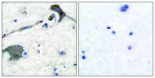 Anti-RASH antibody produced in rabbit