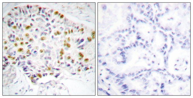 Anti-Retinoblastoma antibody produced in rabbit