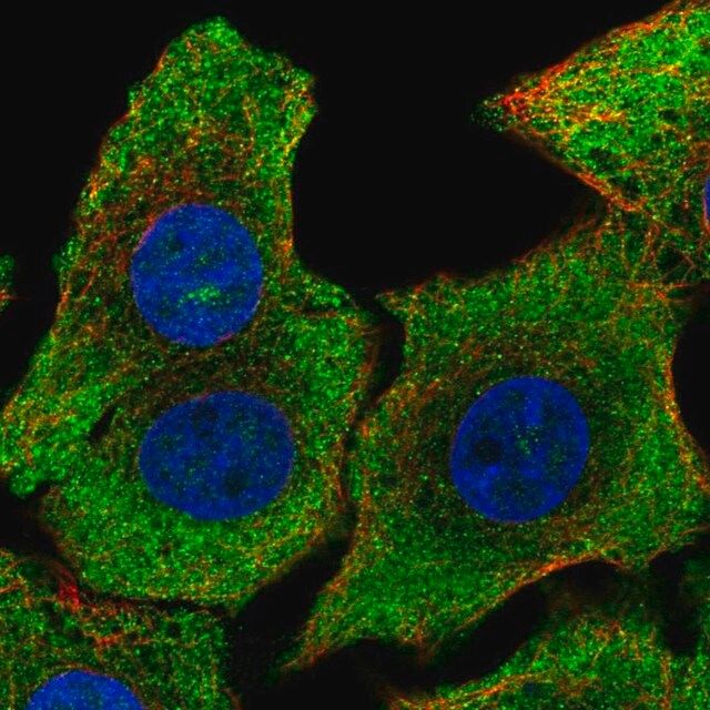 Anti-SHB antibody produced in rabbit