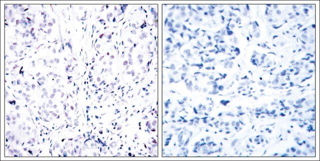 Anti-RB1 (Ab-807) antibody produced in rabbit