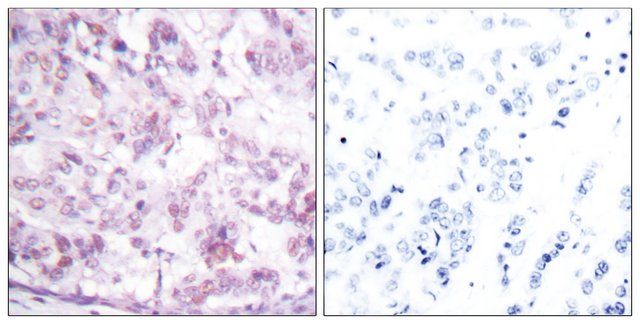 Anti-MYB antibody produced in rabbit