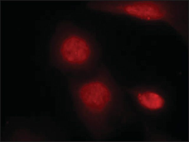 Anti-phospho-AR (pSer<sup>213</sup>) antibody produced in rabbit