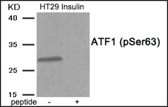 Anti-phospho-ATF1 (pSer<sup>63</sup>) antibody produced in rabbit