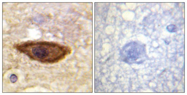 Anti-Interferon- Receptor  chain antibody produced in rabbit