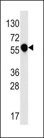 ANTI-IL1R (C-TERM E487) antibody produced in rabbit