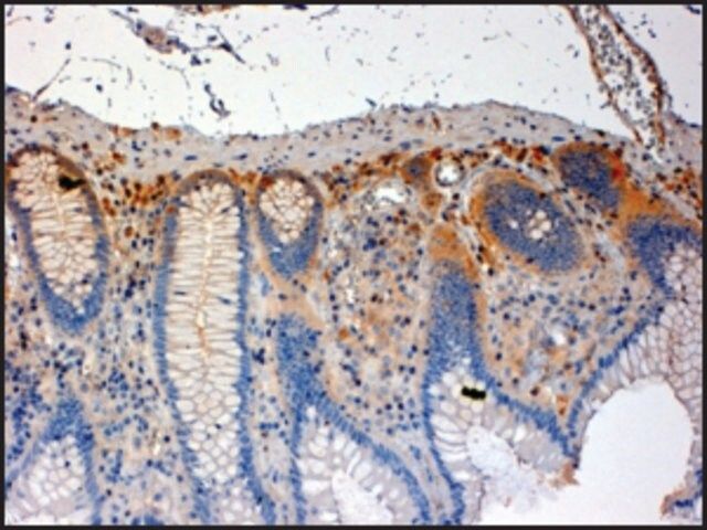 Anti-CSK antibody produced in goat