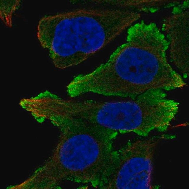 Anti-EFNB1 antibody produced in rabbit