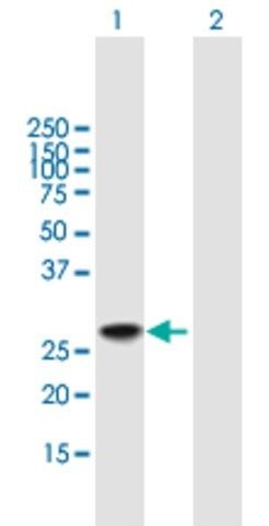 Anti-DDIT3 antibody produced in mouse