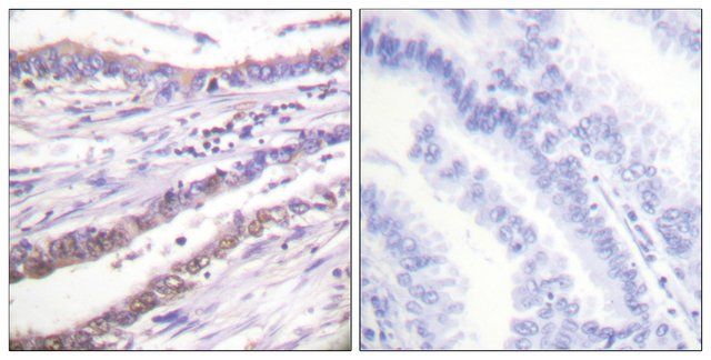 Anti-Cyclin A antibody produced in rabbit