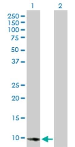 Anti-E2F2 antibody produced in mouse