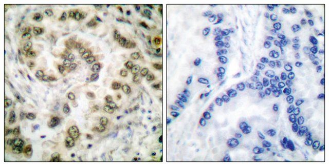 Anti-E2F4 antibody produced in rabbit