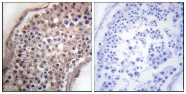 Anti-EFNB1 antibody produced in rabbit