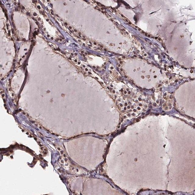 Anti-DDIT3 antibody produced in rabbit