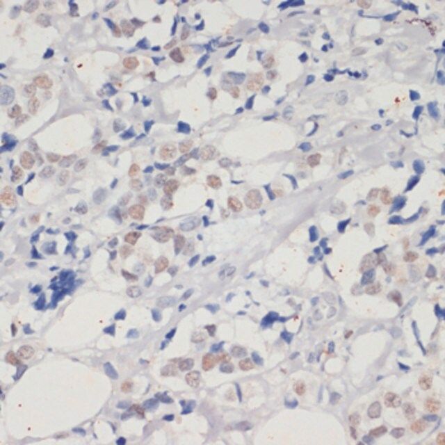 Anti-DNMT1 antibody produced in rabbit