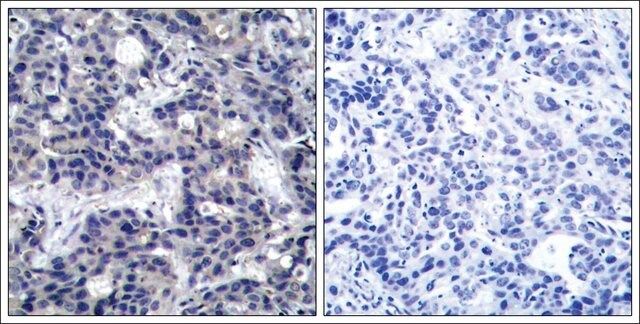 Anti-EIF2AK2 (Ab-446) antibody produced in rabbit