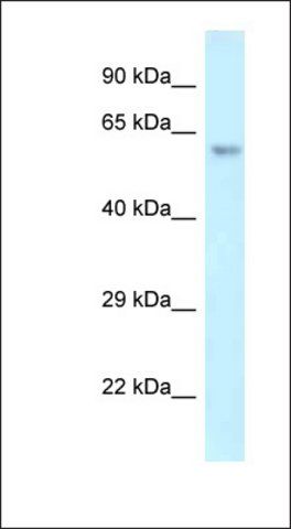 Anti-ERG antibody produced in rabbit