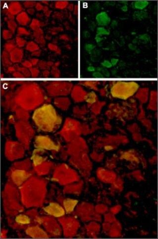 Anti-TRPV4 antibody produced in rabbit