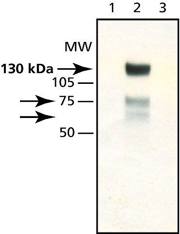 Anti-Synphilin-1 antibody produced in rabbit