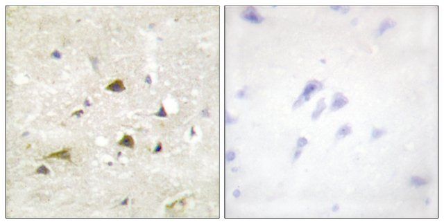 Anti-IKK- antibody produced in rabbit