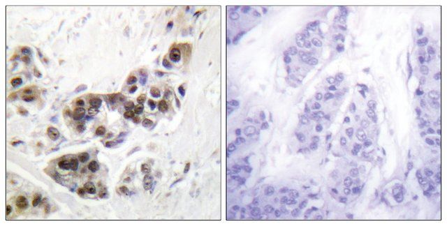 Anti-p53 antibody produced in rabbit