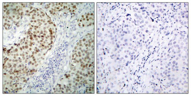 Anti-p53 antibody produced in rabbit