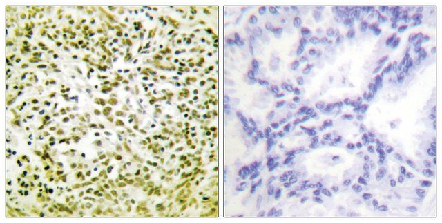 Anti-p53 antibody produced in rabbit