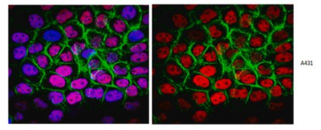 Anti-p53 (pantropic) Antibody, clone DO-1