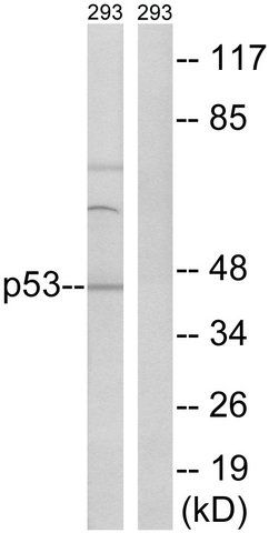 Anti-p53 antibody produced in rabbit