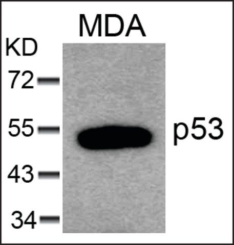 Anti-TP53 (Ab-6) antibody produced in rabbit