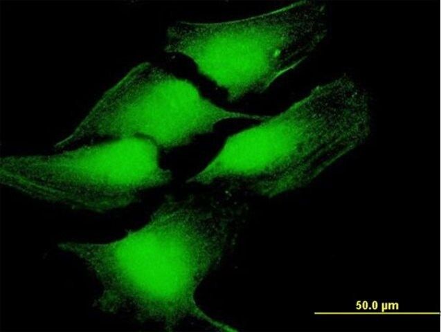 Anti-TP53 antibody produced in mouse