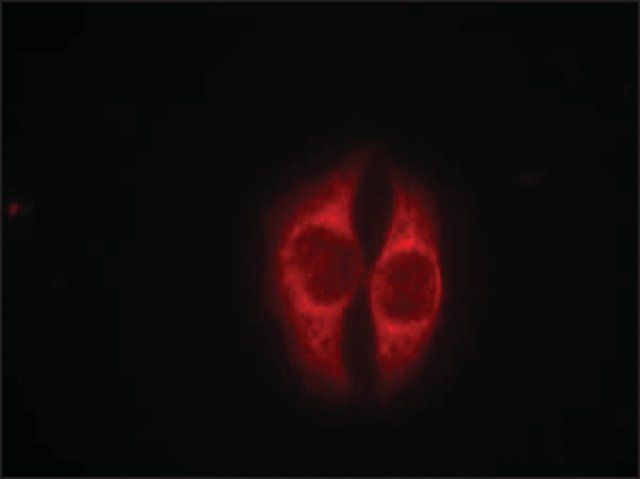 Anti-phospho-TP53 (pSer<sup>37</sup>) antibody produced in rabbit