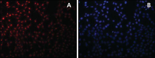 Anti-Sirt7 antibody produced in rabbit